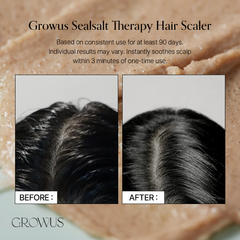 GROWUS Sea Salt Therapy Scalp Scaler 250g – Exfoliating Scalp Scrub for Oily, Flaky Scalp